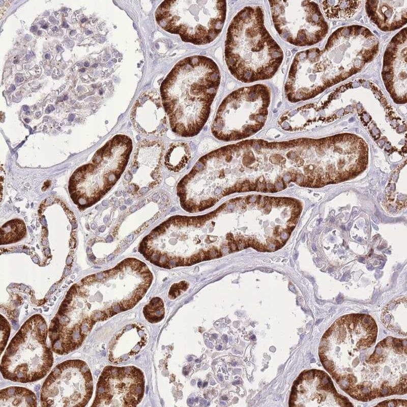 SLC4A4 Antibody - BSA Free Immunohistochemistry: SLC4A4 Antibody - BSA Free [NBP2-32021]