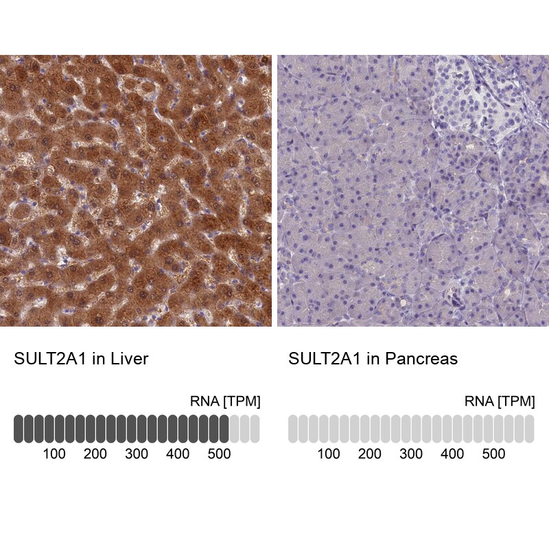 Cytosolic Sulfotransferase 2A1/SULT2A1 Antibody - BSA Free Immunohistochemistry-Paraffin: Cytosolic Sulfotransferase 2A1/SULT2A1 Antibody [NBP2-32604]