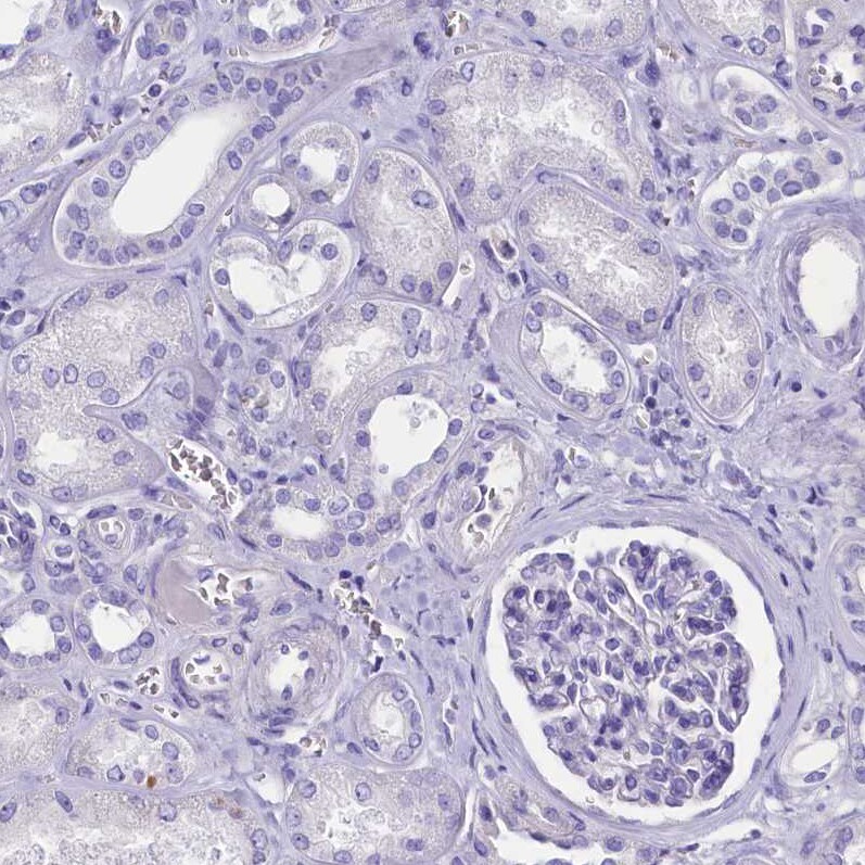 Cytosolic Sulfotransferase 2A1/SULT2A1 Antibody - BSA Free Immunohistochemistry-Paraffin: Cytosolic Sulfotransferase 2A1/SULT2A1 Antibody [NBP2-32604]