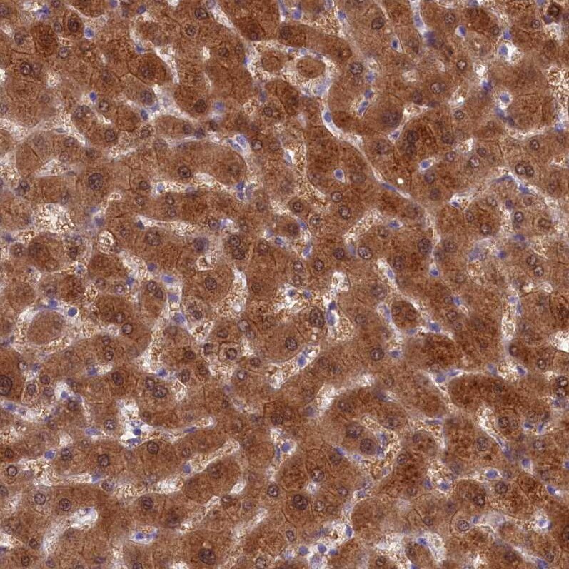 Cytosolic Sulfotransferase 2A1/SULT2A1 Antibody - BSA Free Immunohistochemistry-Paraffin: Cytosolic Sulfotransferase 2A1/SULT2A1 Antibody [NBP2-32604]