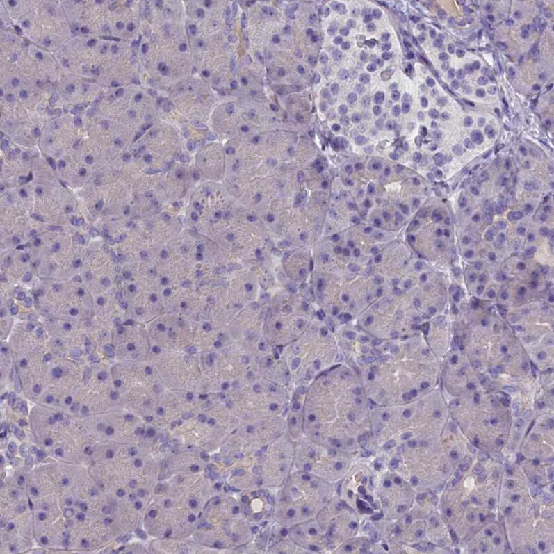 Cytosolic Sulfotransferase 2A1/SULT2A1 Antibody - BSA Free Immunohistochemistry-Paraffin: Cytosolic Sulfotransferase 2A1/SULT2A1 Antibody [NBP2-32604]
