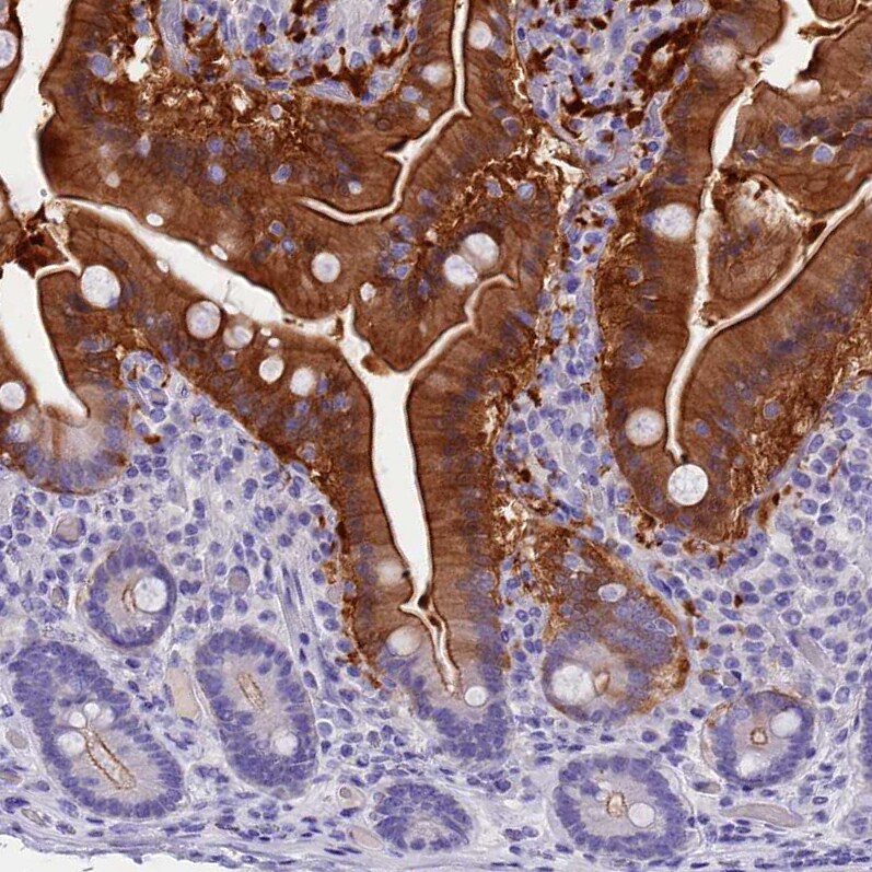 Cytosolic Sulfotransferase 2A1/SULT2A1 Antibody - BSA Free Immunohistochemistry-Paraffin: Cytosolic Sulfotransferase 2A1/SULT2A1 Antibody [NBP2-32604]