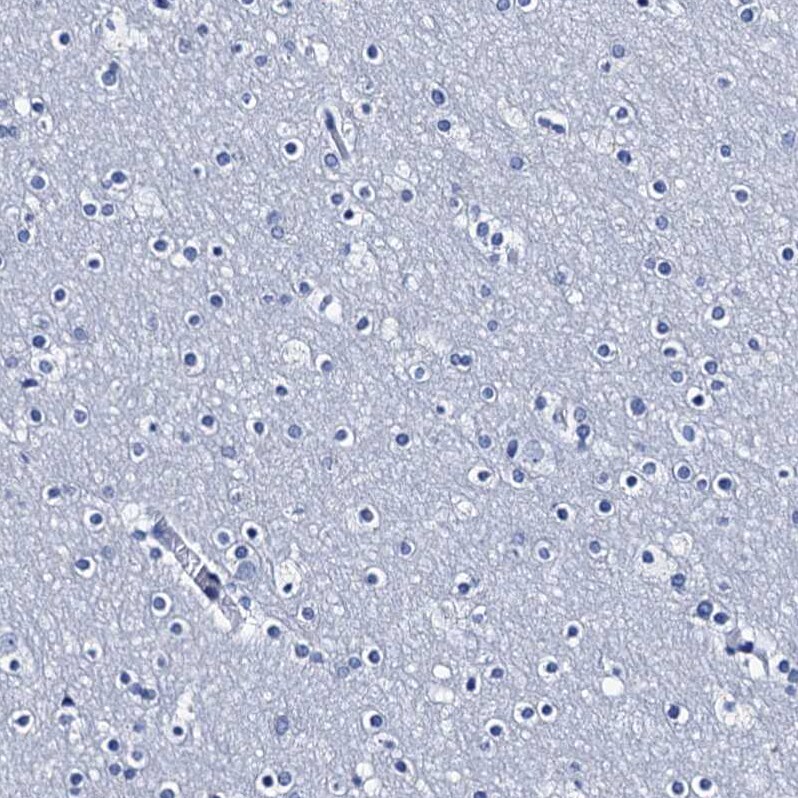 C4.4A/LYPD3 Antibody - BSA Free Immunohistochemistry-Paraffin: C4.4A/LYPD3 Antibody [NBP2-32605]