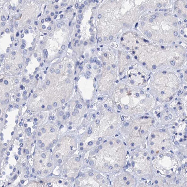 C4.4A/LYPD3 Antibody - BSA Free Immunohistochemistry-Paraffin: C4.4A/LYPD3 Antibody [NBP2-32605]