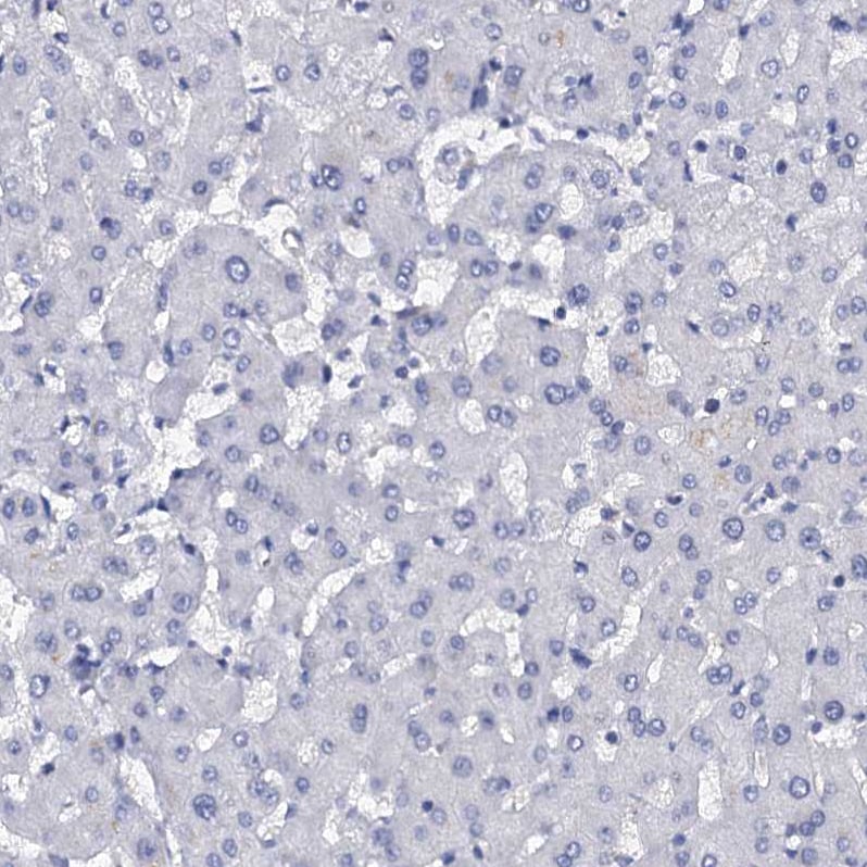 C4.4A/LYPD3 Antibody - BSA Free Immunohistochemistry-Paraffin: C4.4A/LYPD3 Antibody [NBP2-32605]