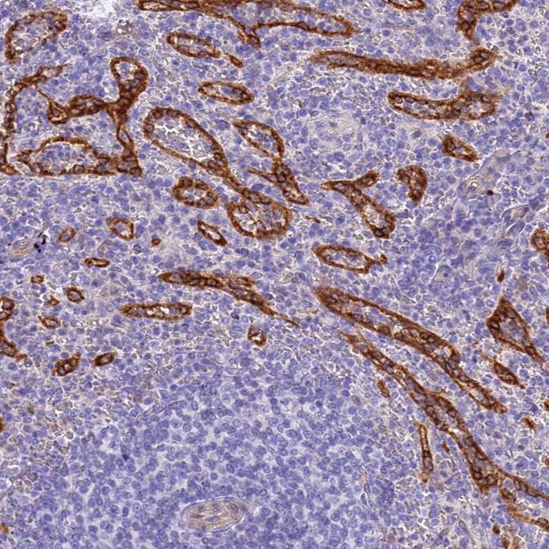 HOMER3 Antibody - BSA Free Immunohistochemistry-Paraffin: HOMER3 Antibody [NBP2-32607]