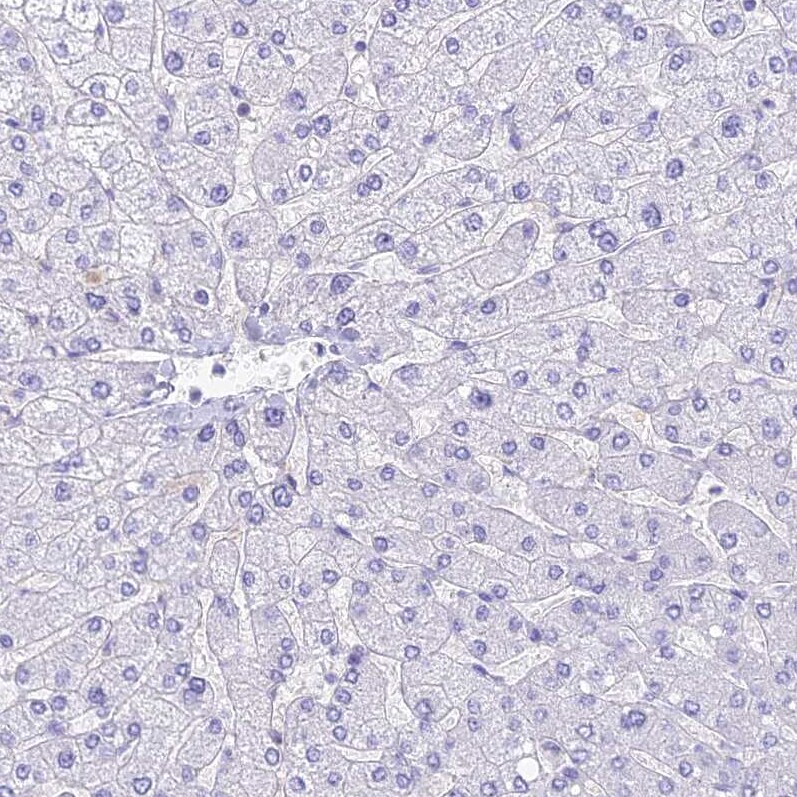 HOMER3 Antibody - BSA Free Immunohistochemistry-Paraffin: HOMER3 Antibody [NBP2-32607]