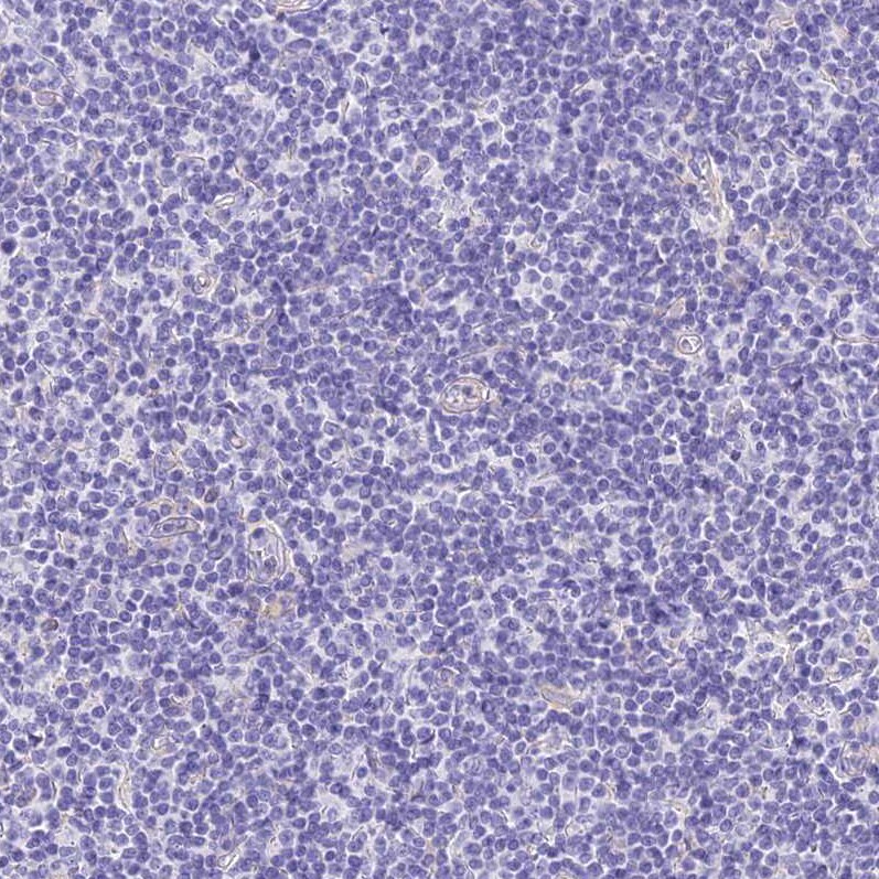 HOMER3 Antibody - BSA Free Immunohistochemistry-Paraffin: HOMER3 Antibody [NBP2-32607]