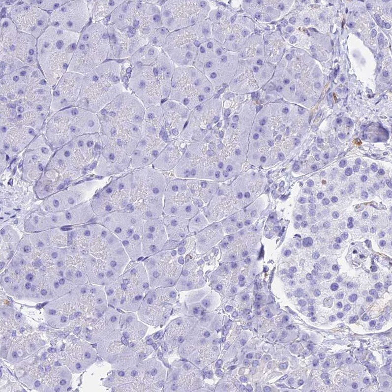 HOMER3 Antibody - BSA Free Immunohistochemistry-Paraffin: HOMER3 Antibody [NBP2-32607]