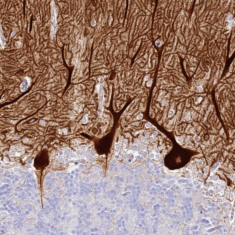 HOMER3 Antibody - BSA Free Immunohistochemistry-Paraffin: HOMER3 Antibody [NBP2-32607]