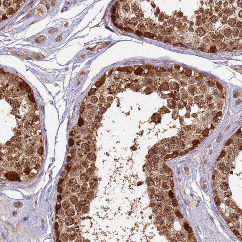 RAPGEF3 Antibody - BSA Free Immunohistochemistry: RAPGEF3 Antibody - BSA Free [NBP2-32615]