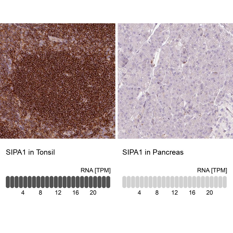 SIPA1 Antibody - BSA Free Immunohistochemistry-Paraffin: SIPA1 Antibody [NBP2-32620]