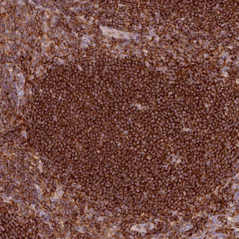 SIPA1 Antibody - BSA Free Immunohistochemistry-Paraffin: SIPA1 Antibody [NBP2-32620]