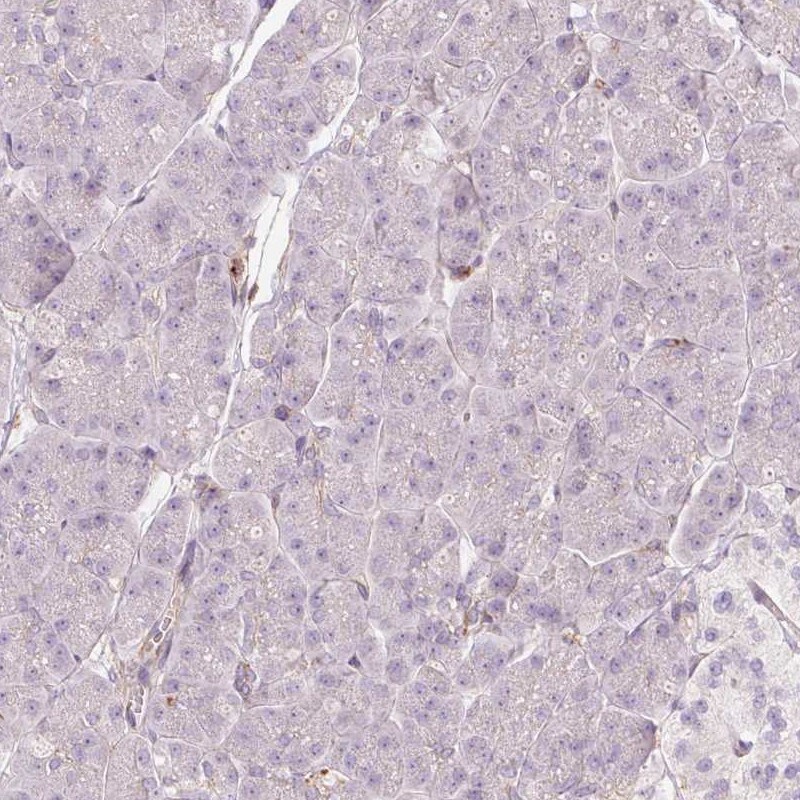 SIPA1 Antibody - BSA Free Immunohistochemistry-Paraffin: SIPA1 Antibody [NBP2-32620]