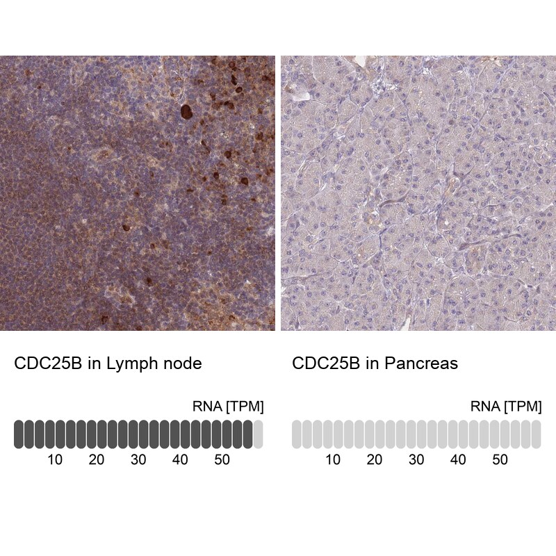 CDC25B Antibody - BSA Free Immunohistochemistry-Paraffin: CDC25B Antibody [NBP2-32626]
