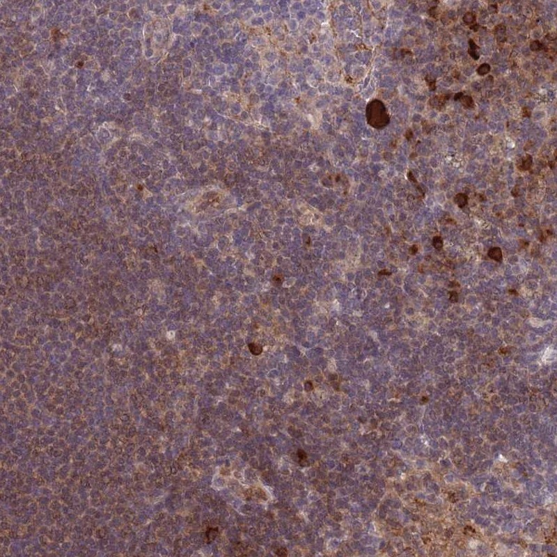 CDC25B Antibody - BSA Free Immunohistochemistry-Paraffin: CDC25B Antibody [NBP2-32626]