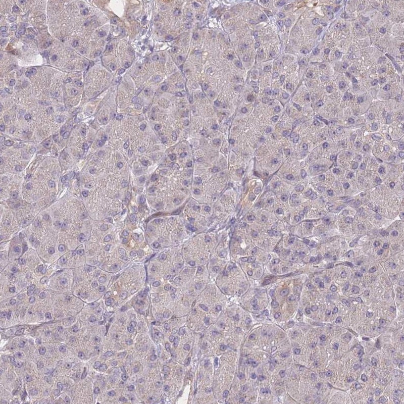 CDC25B Antibody - BSA Free Immunohistochemistry-Paraffin: CDC25B Antibody [NBP2-32626]