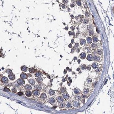 CLPB Antibody - BSA Free Immunohistochemistry-Paraffin: CLPB Antibody [NBP2-32629]