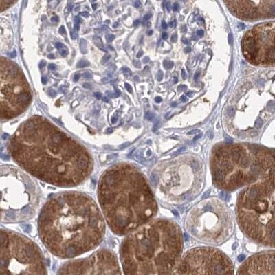 CLPB Antibody - BSA Free Immunohistochemistry-Paraffin: CLPB Antibody [NBP2-32629]