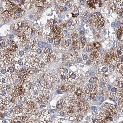 CLPB Antibody - BSA Free Immunohistochemistry-Paraffin: CLPB Antibody [NBP2-32629]
