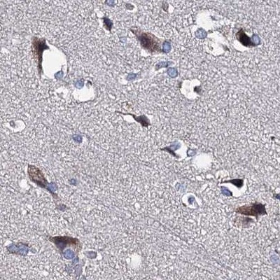 CLPB Antibody - BSA Free Immunohistochemistry-Paraffin: CLPB Antibody [NBP2-32629]