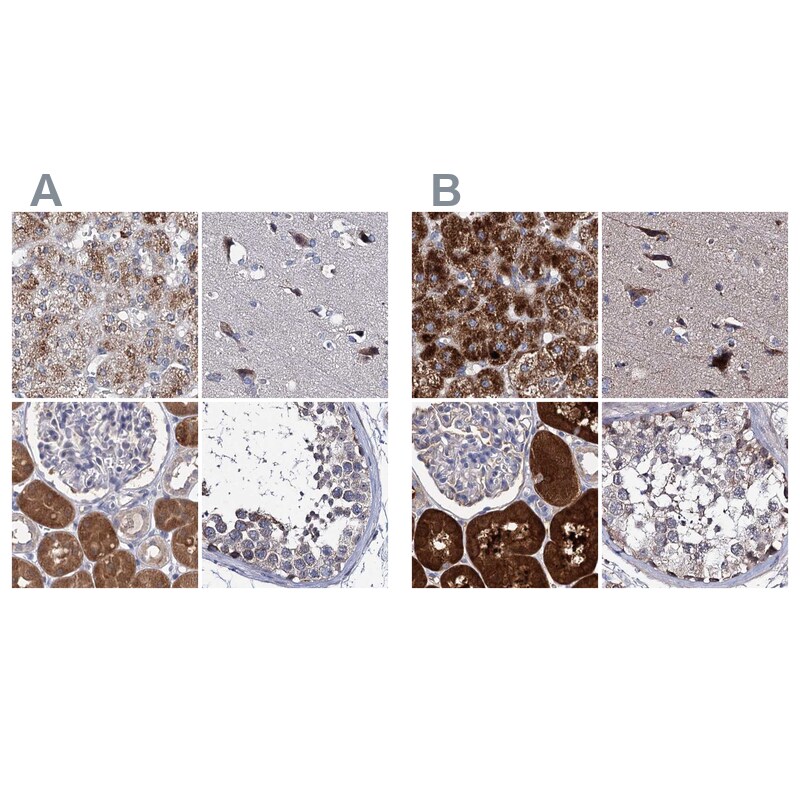 CLPB Antibody - BSA Free Immunohistochemistry-Paraffin: CLPB Antibody [NBP2-32629]