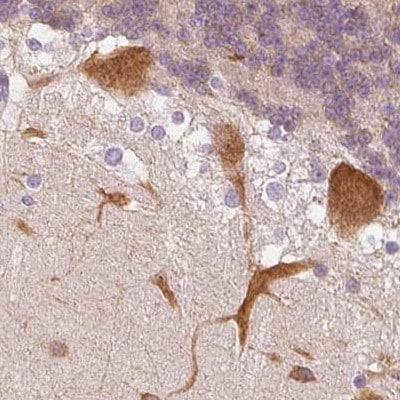 MAP1A Antibody - BSA Free Immunohistochemistry: MAP1A Antibody - BSA Free [NBP2-32630]