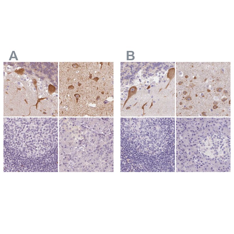 MAP1A Antibody - BSA Free Immunohistochemistry: MAP1A Antibody - BSA Free [NBP2-32630]