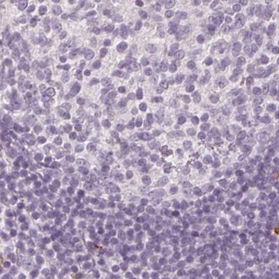 MAP1A Antibody - BSA Free Immunohistochemistry: MAP1A Antibody - BSA Free [NBP2-32630]