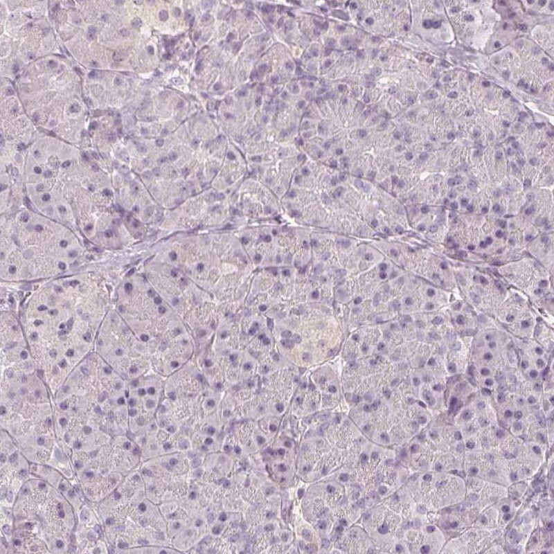 MAP1A Antibody - BSA Free Immunohistochemistry: MAP1A Antibody - BSA Free [NBP2-32630]