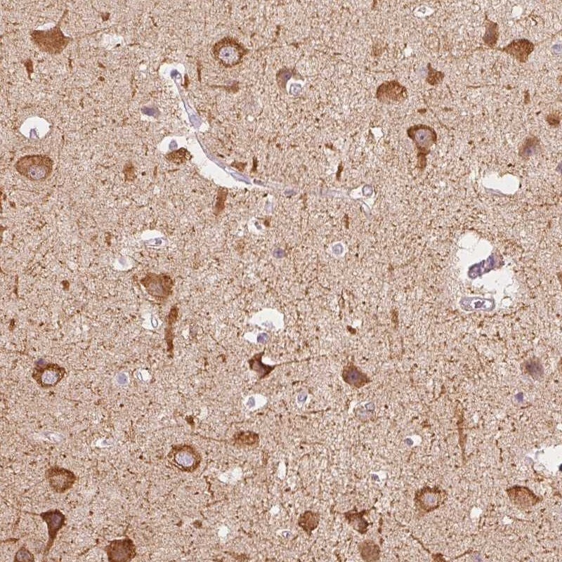 MAP1A Antibody - BSA Free Immunohistochemistry: MAP1A Antibody - BSA Free [NBP2-32630]