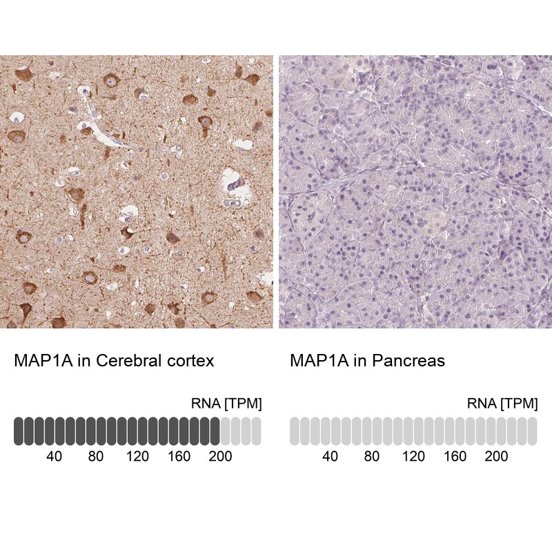 MAP1A Antibody - BSA Free Immunohistochemistry: MAP1A Antibody - BSA Free [NBP2-32630]