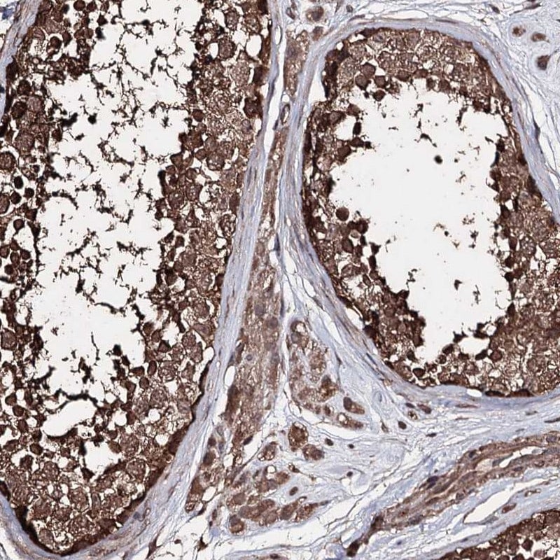 ZNF662 Antibody - BSA Free Immunohistochemistry-Paraffin: ZNF662 Antibody [NBP2-32632]