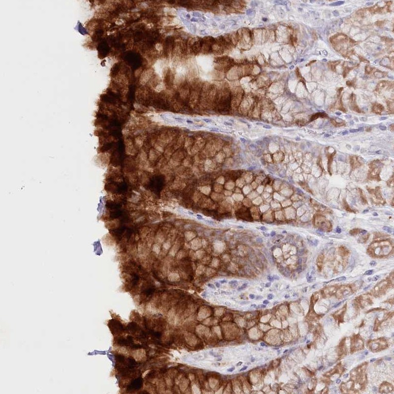 PSAPL1 Antibody - BSA Free Immunohistochemistry-Paraffin: PSAPL1 Antibody [NBP2-32635]