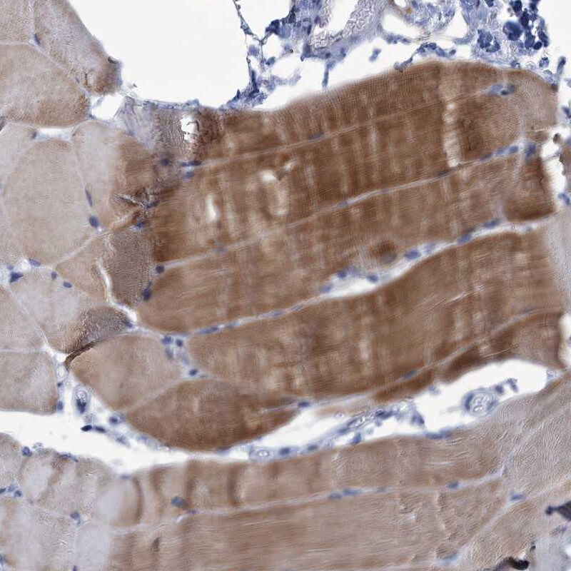 NEU3 Antibody - BSA Free Immunohistochemistry: NEU3 Antibody - BSA Free [NBP2-32644]