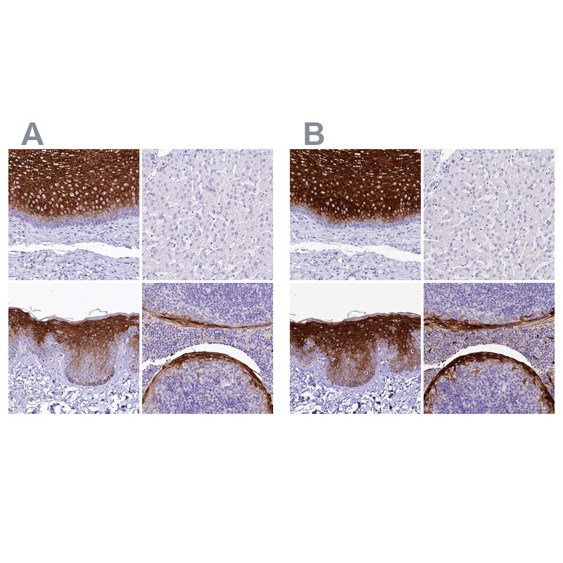 alpha 2-Macroglobulin-like 1/A2ML1 Antibody - BSA Free Immunohistochemistry-Paraffin: alpha 2-Macroglobulin-like 1/A2ML1 Antibody [NBP2-32647]