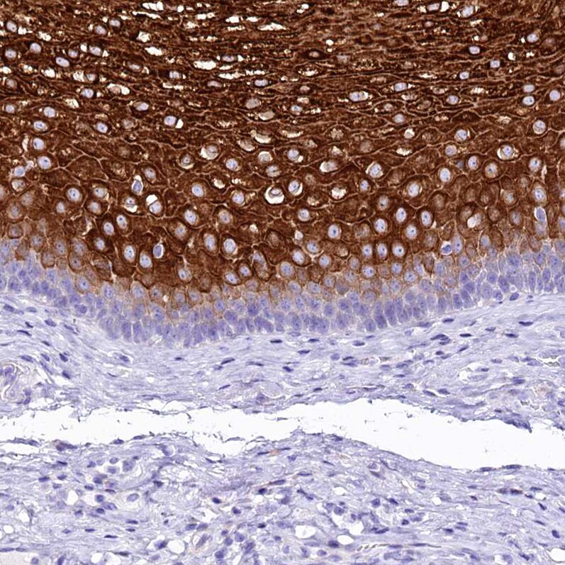 alpha 2-Macroglobulin-like 1/A2ML1 Antibody - BSA Free Immunohistochemistry-Paraffin: alpha 2-Macroglobulin-like 1/A2ML1 Antibody [NBP2-32647]