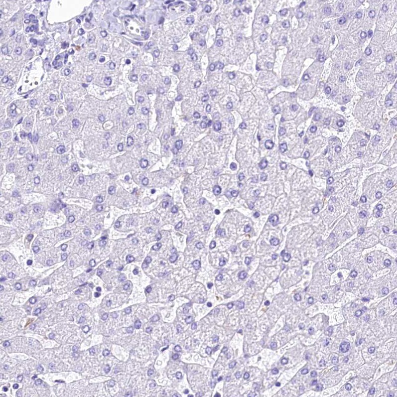 alpha 2-Macroglobulin-like 1/A2ML1 Antibody - BSA Free Immunohistochemistry-Paraffin: alpha 2-Macroglobulin-like 1/A2ML1 Antibody [NBP2-32647]