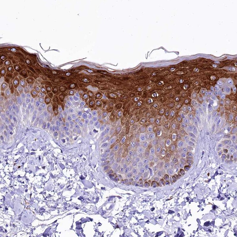 alpha 2-Macroglobulin-like 1/A2ML1 Antibody - BSA Free Immunohistochemistry-Paraffin: alpha 2-Macroglobulin-like 1/A2ML1 Antibody [NBP2-32647]