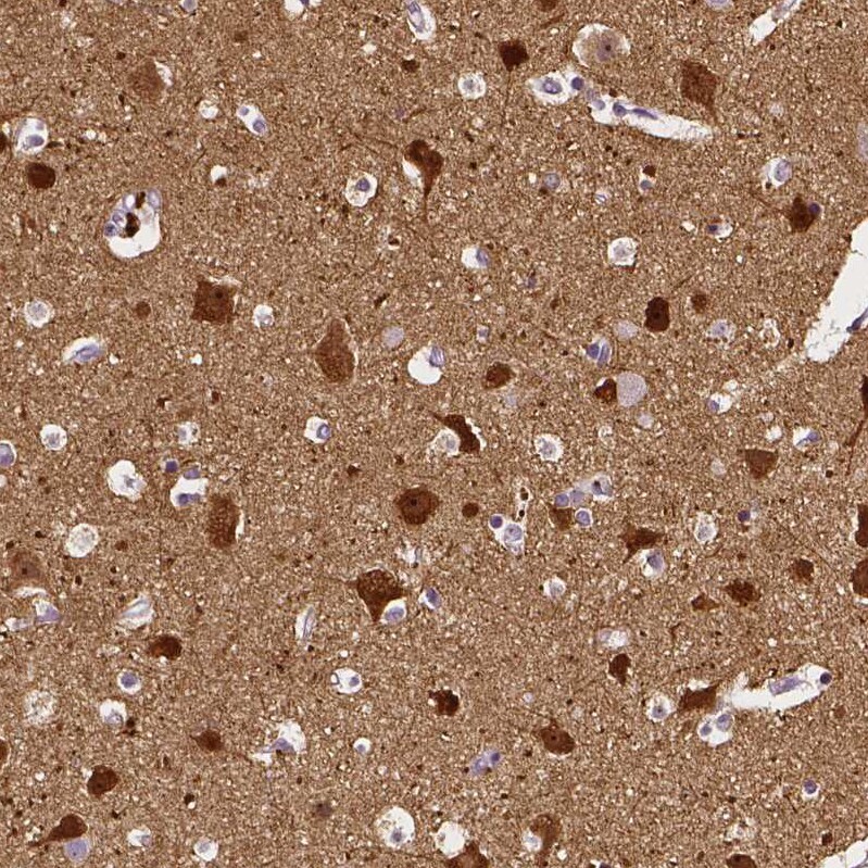 Neurogranin Antibody - BSA Free Immunohistochemistry-Paraffin: Neurogranin Antibody [NBP2-32655]