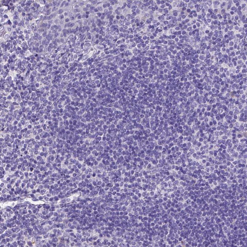 Neurogranin Antibody - BSA Free Immunohistochemistry-Paraffin: Neurogranin Antibody [NBP2-32655]