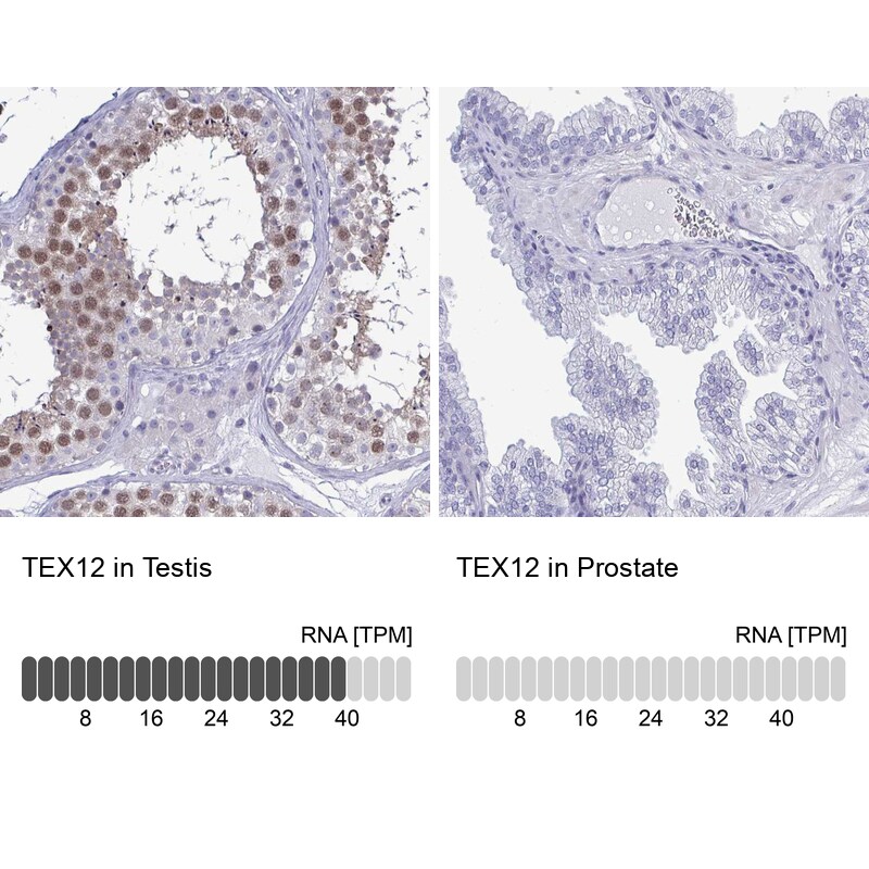 TEX12 Antibody - BSA Free Immunohistochemistry-Paraffin: TEX12 Antibody [NBP2-32656]