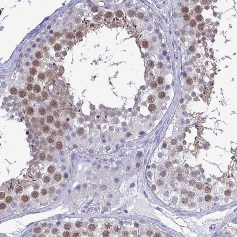 TEX12 Antibody - BSA Free Immunohistochemistry-Paraffin: TEX12 Antibody [NBP2-32656]
