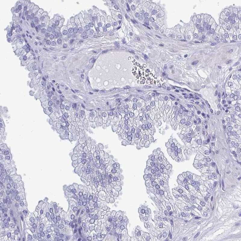 TEX12 Antibody - BSA Free Immunohistochemistry-Paraffin: TEX12 Antibody [NBP2-32656]