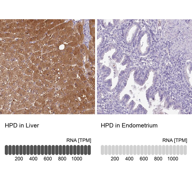 HPD Antibody - BSA Free Immunohistochemistry-Paraffin: HPD Antibody [NBP2-32657]