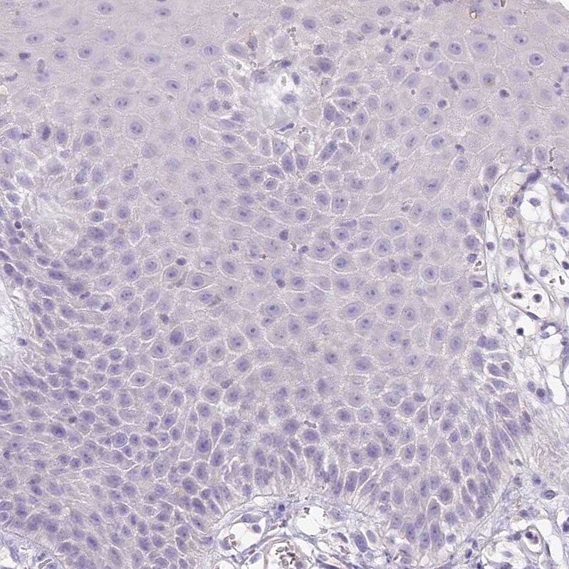 HPD Antibody - BSA Free Immunohistochemistry-Paraffin: HPD Antibody [NBP2-32657]