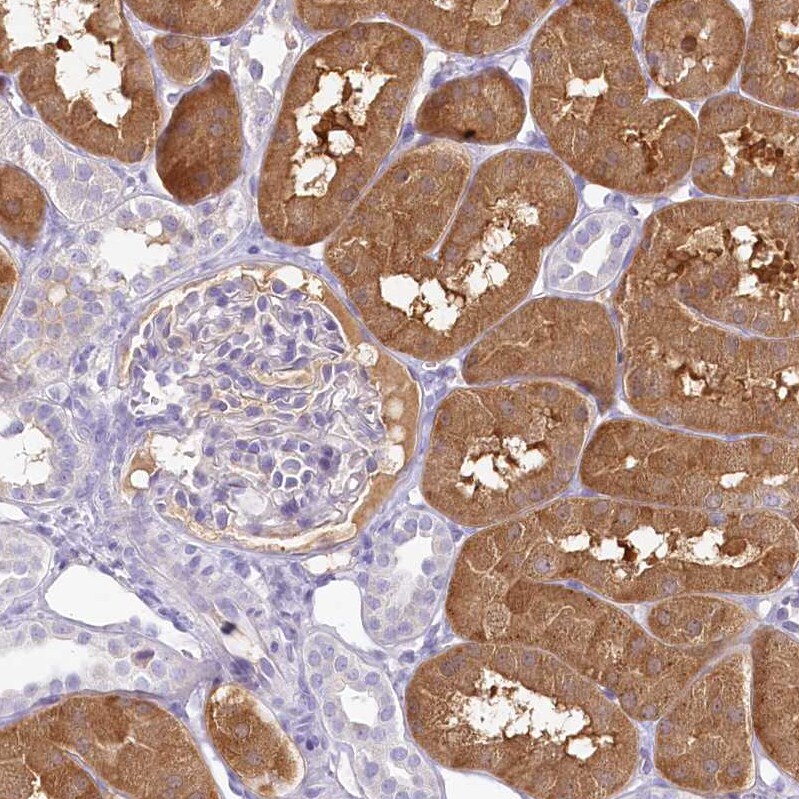 HPD Antibody - BSA Free Immunohistochemistry-Paraffin: HPD Antibody [NBP2-32657]