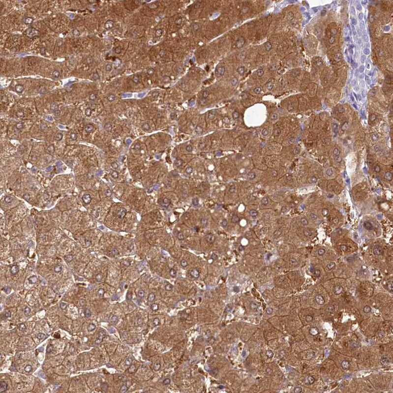 HPD Antibody - BSA Free Immunohistochemistry-Paraffin: HPD Antibody [NBP2-32657]