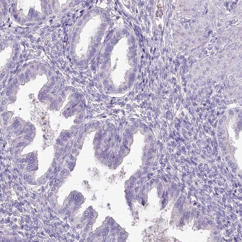 HPD Antibody - BSA Free Immunohistochemistry-Paraffin: HPD Antibody [NBP2-32657]