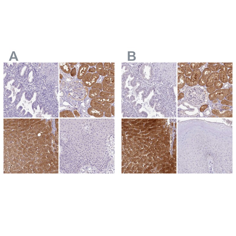 HPD Antibody - BSA Free Immunohistochemistry-Paraffin: HPD Antibody [NBP2-32657]